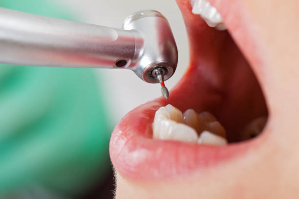 Best Emergency Cosmetic Dentistry in Hydro, OK